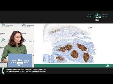 Видео: HPV-позитивные и негативные раки  при опухолях головы и шеи (Артемьева А.С.)