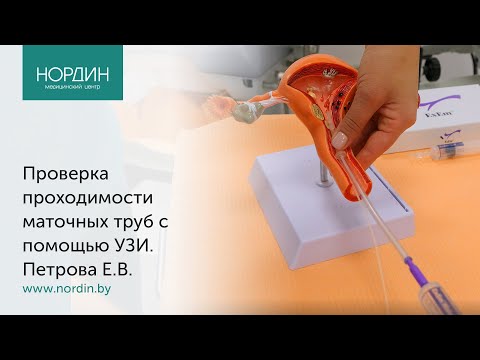 Видео: Проверка проходимости маточных труб с помощью УЗИ