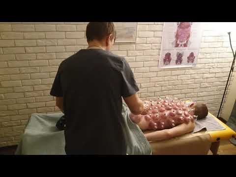 Видео: Быстрый способ избавится от боли в спине. Постановка вакуумных банок.