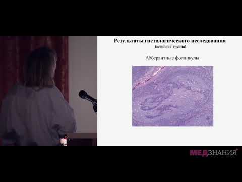 Видео: 14 Клинико морфологические аспекты хронического аденоидита у детей