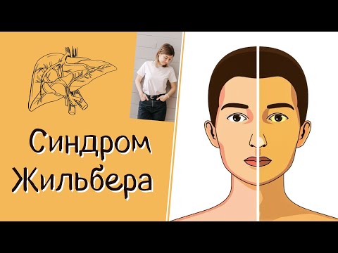 Видео: Синдром Жильбера