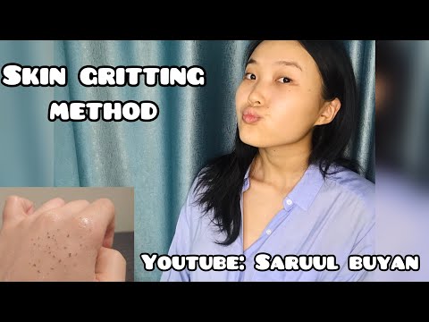 Видео: Хар батга хайлуулах арга Skin gritting method