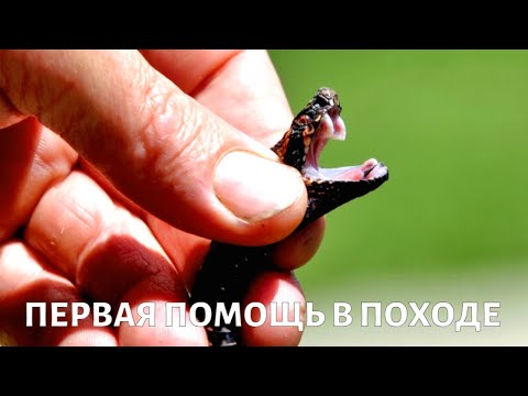 Видео: Укус змеи, растяжение связок, ожог борщевиком: правила безопасности в походе