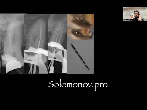 Видео: Сломанный инструмент