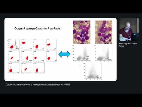 Видео: Сложности и ошибки в иммунофенотипировании ОМЛ