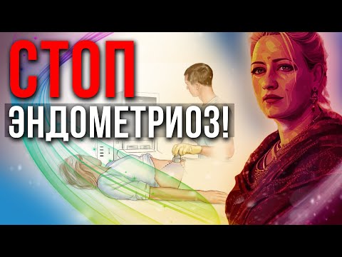 Видео: Эндометриоз. Истинные причины болезни могут вас удивить.