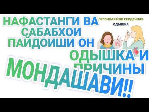 Видео: ЧАРО ЗУД НАФАСАМОН МЕГАРДАД🤔🤔//БЁЧАРО БИСЁР РОҲ РАФТА НАМЕТОНЕМ🤔🤔//ПРИЧИНЫ ОДЫШКА