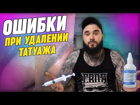 Видео: Девушки, никогда не делайте ТАК! / Как правильно удалить неудачный татуаж бровей?