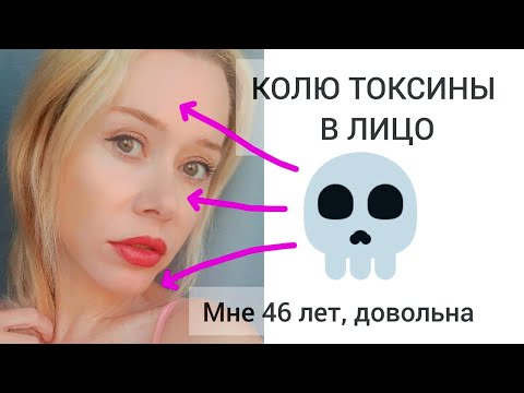 Видео: Ботокс для мимических морщин. Делать или нет? Мой опыт. Лето с Машей 🌞 Видео #32 #летосмашей