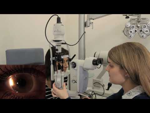 Видео: Методы щелевой лампы: склеротическое рассеяние