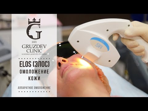 Видео: Элос   ELOS   омоложение кожи или как это работает