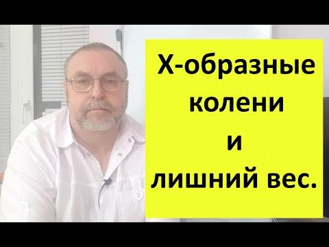 Видео: Х-образные колени, лишний вес. Почему возникают, и как устранить.
