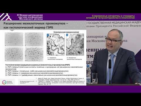 Видео: Эзофагопротектор – новый терапевтический класс в терапии ГЭРБ