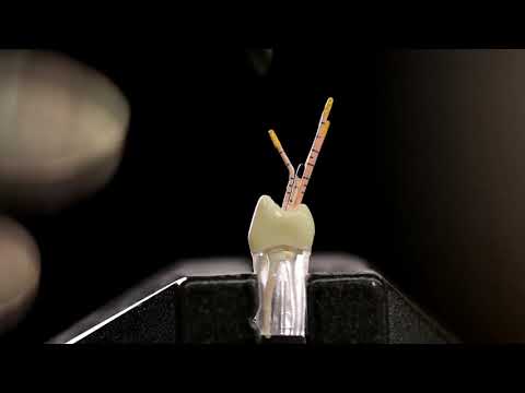 Видео: ObturEst Беспроводной аппарат для обтурации корневых каналов Geosoft EndoLine Обзор