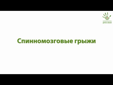 Видео: Видео-лекция "Спинномозговые грыжи"