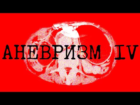 Видео: АНЕВРИЗМ IV - Шпигун