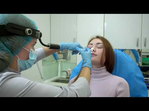 Видео: Вазотомія нижніх носових раковин.