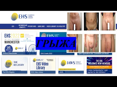 Видео: Грыжа. Введение в герниологию.