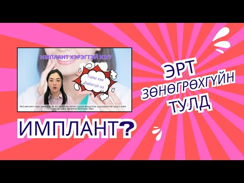 Видео: ИМПЛАНТ /эрт зөнөгрөхгүйн тулд/