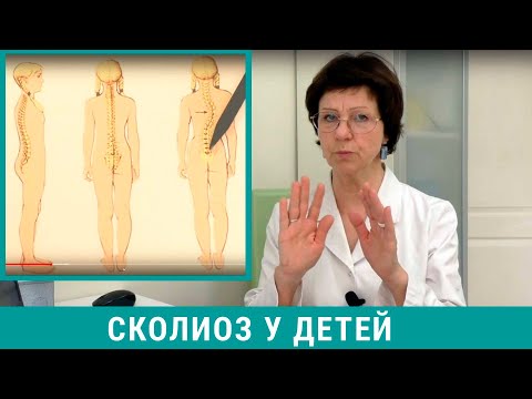 Видео: Лечение сколиоза у детей