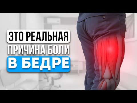 Видео: БОЛИТ бок бедра? СРОЧНО проверьтесь! Это может быть ТРОХАНТЕРИТ!