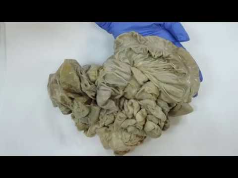 Видео: Видеозанятие 25 «Органы пищеварения (часть 4)»