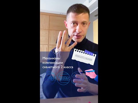 Видео: 1. Про механизмы компенсации скелетного 2 класса | #конспектсеминара