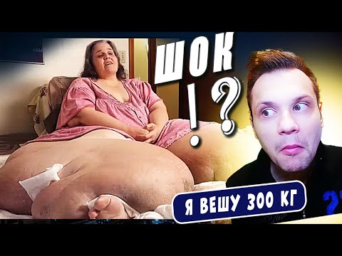 Видео: ЖЕСТЬ! САМЫЕ БОЛЬШИЕ НОГИ В МИРЕ!  Я вешу 300 кг! История Трейси Метьюс сезон 5