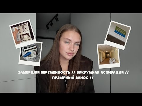 Видео: МОЯ ИСТОРИЯ ЗАМЕРШЕЙ БЕРЕМЕННОСТИ // ВАКУУМНАЯ АСПИРАЦИЯ // ПУЗЫРНЫЙ ЗАНОС //