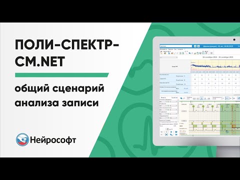 Видео: Общий сценарий анализа записи амбулаторного мониторирования в программе Поли-Спектр-СМ.NET