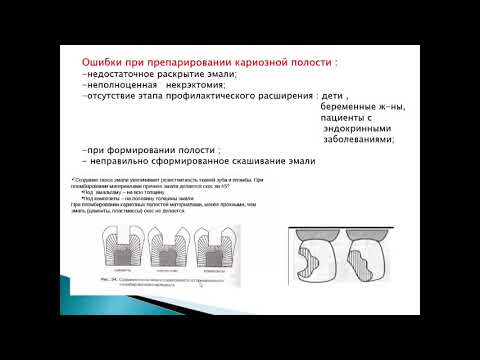 Видео: Кариесология 12. Ошибки в диагностике и лечении кариеса