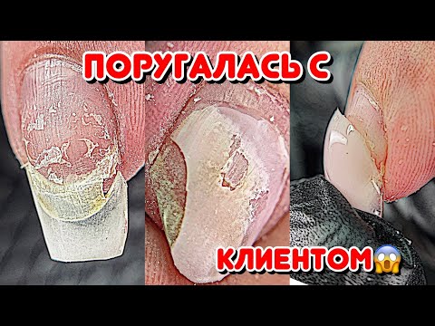 Видео: Поругалась с клиентом? 😕 Залила ноготь клеем 💅 Маникюр / Ремонт ногтя