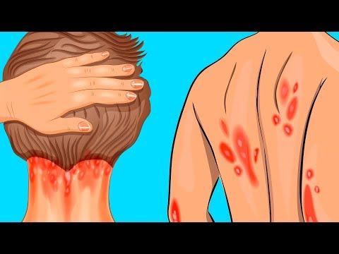 Видео: 10 Тревожных Признаков того, что вам Не Хватает Витамина D