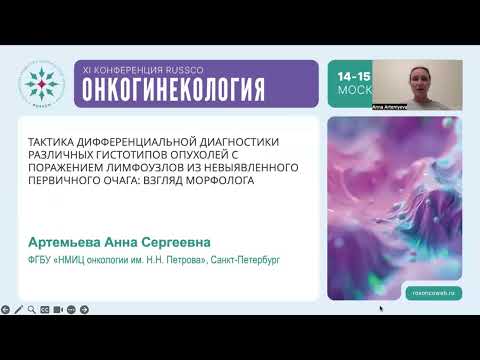 Видео: Тактика дифференциальной диагностики разных гистотипов опухолей с поражением ЛУ: взгляд морфолога