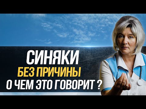 Видео: Почему появляются синяки на теле без причины, о чем это говорит, что делать и чем может быть опасно?