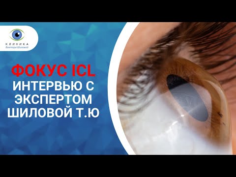Видео: Фокус ICL | Кератоконус | Шилова Т Ю