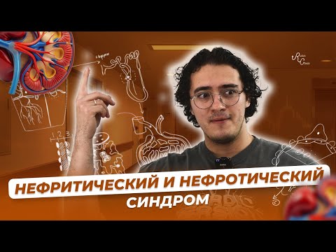 Видео: Нефритический и нефротический синдром. Этиология, патогенез, клиническая картина, диагностика.