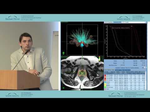 Видео: Кибер-нож в лечении рака предстательной железы низкого риска