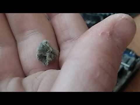 Видео: Прочистка старенького ноутбука samsung. 5 лет без чистки от пыли!