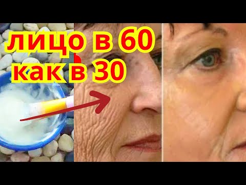 Видео: НАНЕСИТЕ Только 1 Раз и Кожа Станет Гладкой!  Маска от Глубоких Морщин для Лица Рецепт