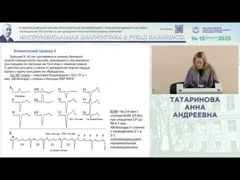 Видео: Ценность ЭКГ-нагрузочных проб при нарушениях сердечной проводимости