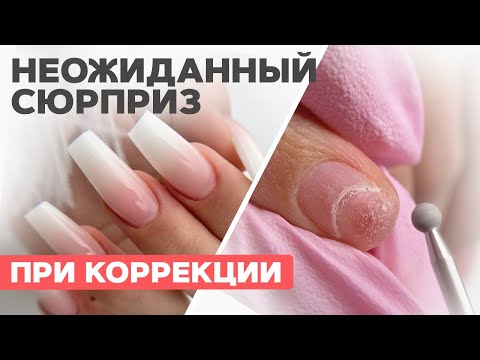 Видео: Клюющие ногти | Форма балерина | Онихолизис