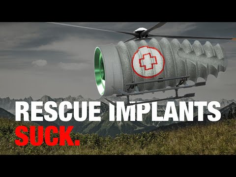 Видео: Используйте эти 3+ ПРАВИЛА, чтобы каждый раз выбирать имплант ПРАВИЛЬНОГО РАЗМЕРА!