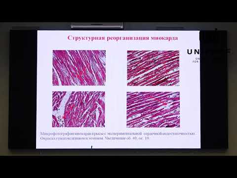 Видео: "Микробиоценоз кишечника при сердечной недостаточности по данным МСММ в крови"