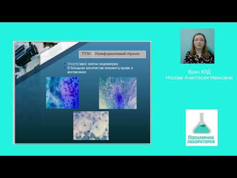 Видео: Экскурсия по международным классификациям в клинической цитологии. Вебинар 11.