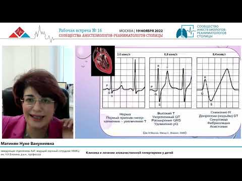 Видео: Злокачественная гипертермия Матинян Н.В.