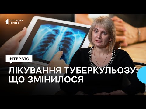 Видео: Туберкульоз: що змінилося в лікуванні дорослих та дітей | Інтерв'ю з Жанною Карпенко