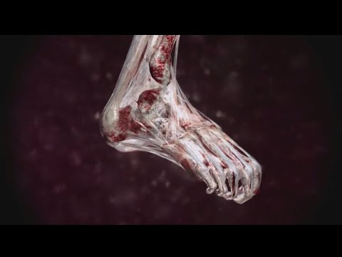 Видео: Блиц-опрос о травмах и основных моментах лиги 2