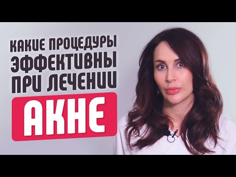 Видео: Всё об акне - проверенные и эффективные процедуры