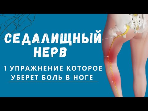 Видео: Защемило седалищный нерв? Прострелы закончатся.